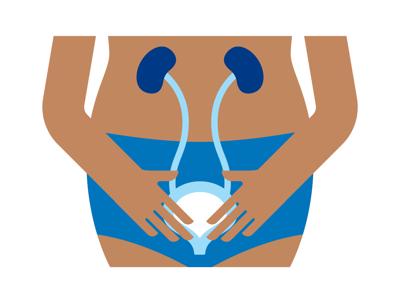 Prolapsed Bladder Prolapsed Bladder